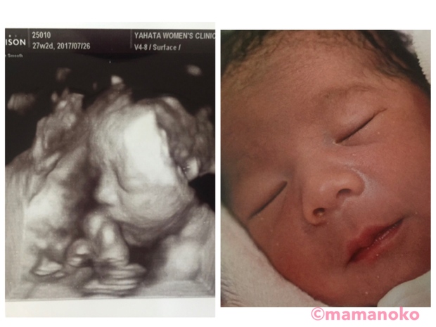 3Dエコーはいつから？性別がわかる？写真の見方・料金・実際の顔との違いについて ままのて