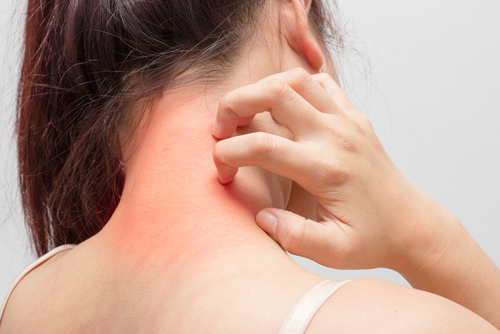 妊娠中に湿疹が手足やお腹にできた！原因は？薬で治る？